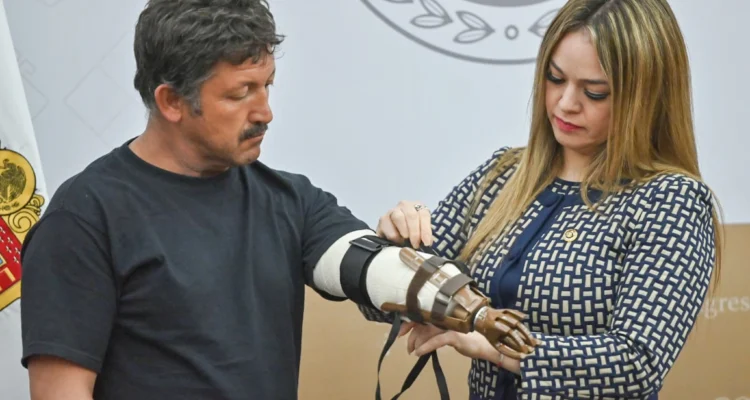 Promueve Jennifer González colaboración para entrega de prótesis
